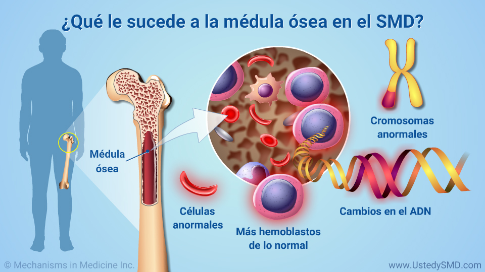 Abnormal program. The Fever of the Bone.